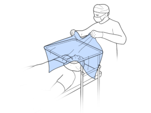 Removing Drape